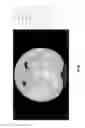 Fig. 24 - Medical scan annotator system