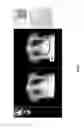 Fig. 34 - Medical scan annotator system
