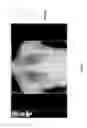 Fig. 43 - Medical scan annotator system