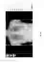 Fig. 44 - Medical scan annotator system