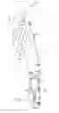 Fig. 14 - Inspection tool