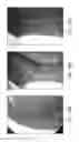 Fig. 17 - JET PUMP PLUG SEAL AND METHODS OF MAKING AND USING SAME