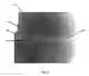 Fig. 07 - WIG APPARATUS AND METHOD OF MANUFACTURING SAME