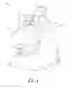 Fig. 02 - CHILD SUPPORT DEVICE