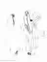 Fig. 03 - Atraumatic stapling head features for circular surgical stapler