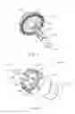 Fig. 04 - Atraumatic stapling head features for circular surgical stapler
