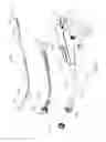 Fig. 06 - Atraumatic stapling head features for circular surgical stapler
