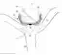 Fig. 01 - Occlusion device