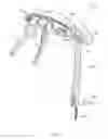 Fig. 02 - Surgical cord tensioning devices, systems, and methods