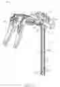 Fig. 09 - Surgical cord tensioning devices, systems, and methods