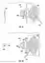 Fig. 16 - Selective transparency to assist medical device navigation