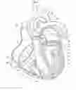 Fig. 02 - CARDIAC MAPPING AND NAVIGATION FOR TRANSCATHETER PROCEDURES