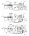 Fig. 05 - CARDIAC MAPPING AND NAVIGATION FOR TRANSCATHETER PROCEDURES