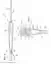 Fig. 06 - User Control Pendant Assembly For Remotely Controlling Surgical Device