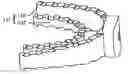 Fig. 01 - BRACKET-TYPE TOOTH CLEANER