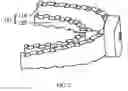 Fig. 03 - BRACKET-TYPE TOOTH CLEANER