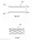 Fig. 07 - Transcatheter prosthesis with sealing component, and systems and methods for delivering and deployment thereof