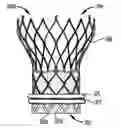 Fig. 01 - Paravalvular sealing via extended cuff mechanisms