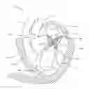 Fig. 01 - Sequentially deployed transcatheter mitral valve prosthesis