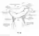 Fig. 07 - Sequentially deployed transcatheter mitral valve prosthesis