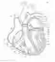 Fig. 01 - Transcatheter device for treating mitral regurgitation