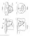 Fig. 07 - Transcatheter device for treating mitral regurgitation