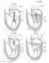 Fig. 08 - Transcatheter device for treating mitral regurgitation
