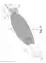 Fig. 09 - Mesh spacer hybrid