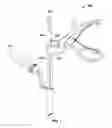 Fig. 02 - Percutaneous bone graft delivery system and method