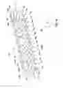 Fig. 02 - Endoluminal prostheses including multiple helical wires
