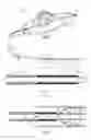 Fig. 02 - Pull wire and spool for vascular intervention device delivery system