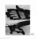 Fig. 08 - WEARABLE AND FUNCTIONAL HAND ORTHOTIC
