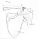 Fig. 01 - Orthopedic devices