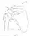 Fig. 02 - Orthopedic devices