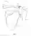 Fig. 03 - Orthopedic devices