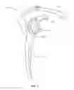 Fig. 04 - Orthopedic devices
