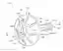 Fig. 01 - Ostomy device, apparatus, and system
