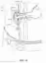 Fig. 20 - Ostomy device, apparatus, and system