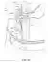 Fig. 24 - Ostomy device, apparatus, and system