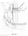 Fig. 28 - Ostomy device, apparatus, and system