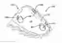 Fig. 01 - Palatal drug delivery