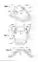 Fig. 02 - Palatal drug delivery