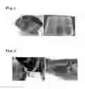 Fig. 02 - Composition containing ivermectin for exterminating infection on 