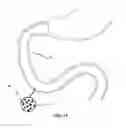 Fig. 12 - System and method for affecting intestinal microbial flora