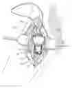 Fig. 01 - Subcutaneous vascular access ports and related systems and methods