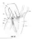 Fig. 07 - Subcutaneous vascular access ports and related systems and methods
