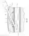 Fig. 20 - Subcutaneous vascular access ports and related systems and methods