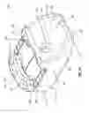 Fig. 28 - Subcutaneous vascular access ports and related systems and methods