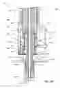 Fig. 35 - Subcutaneous vascular access ports and related systems and methods