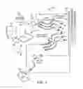 Fig. 02 - Systems and methods for introducing an electrical stimulation lead into a patient
